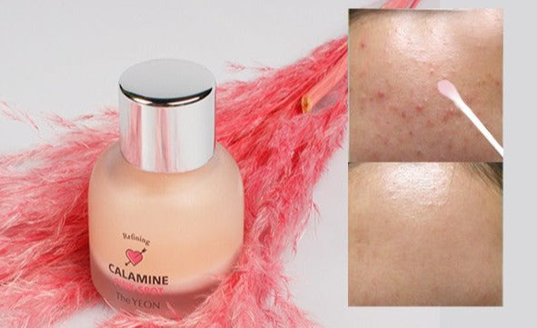 Refining Calamine Pink Spot