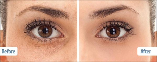 LHQ Advanced Retinol Eye Cream