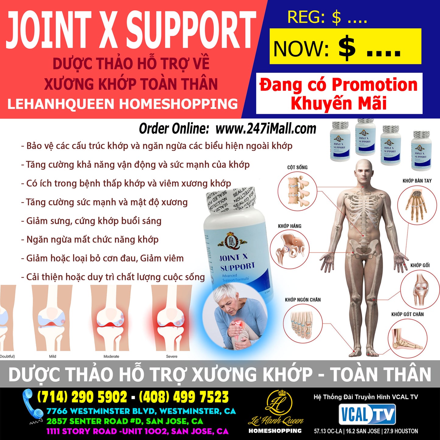 Dược Thảo Hỗ Trợ Xương Khớp Toàn Thân (Joints)